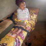 14. Matie Waffo undergoing under stretching in preparation for splinting